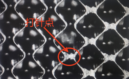 电雕针“打针”到底是怎么回事？